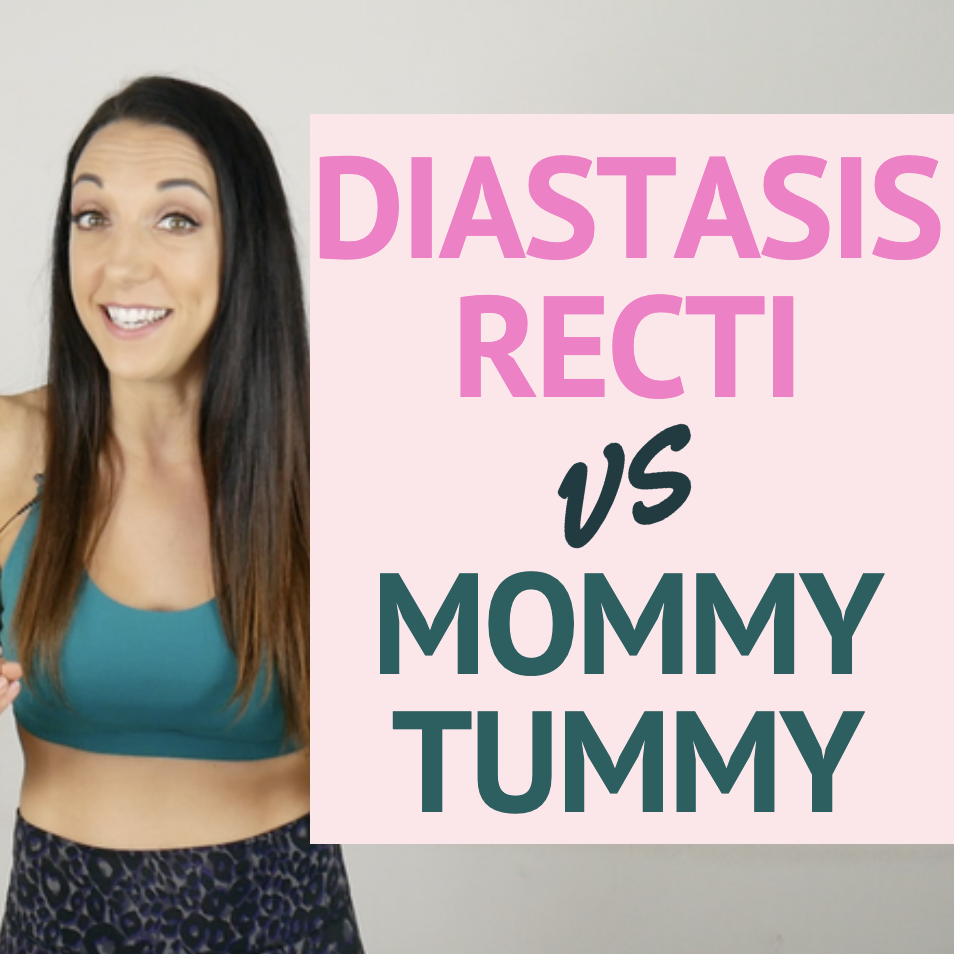 Diastasis Recti Vs. Mommy Tummy - Jessica Joy Life